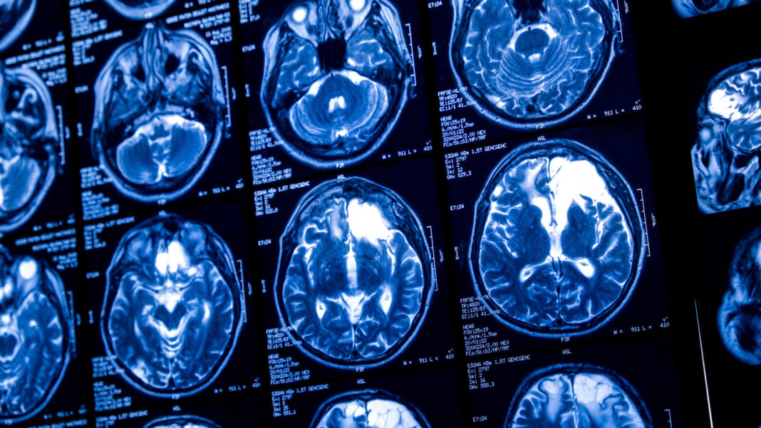 usamos-so-10%-do-nosso-cerebro-mesmo?-definitivamente,-nao