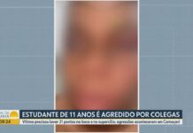 Estudante de 11 anos sofre agressão de colegas em Camaçari