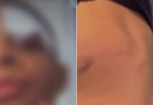 Menino de 11 anos é agredido por colegas dentro de escola em Camaçari