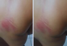 Criança com neurodivergência sofre agressão em escola municipal de Camaçari