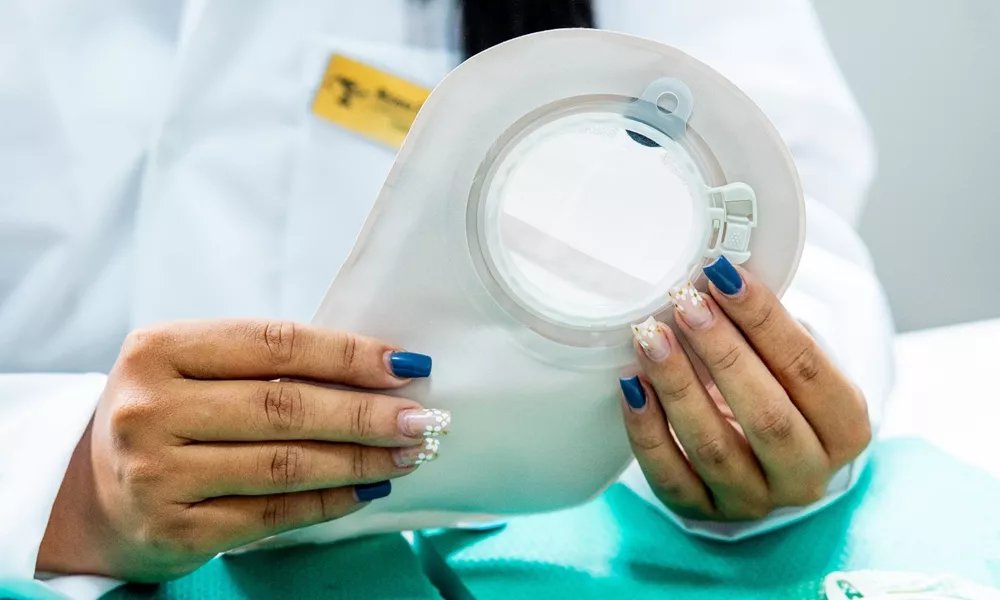 Atendimento a Pessoas Ostomizadas na Policlínica